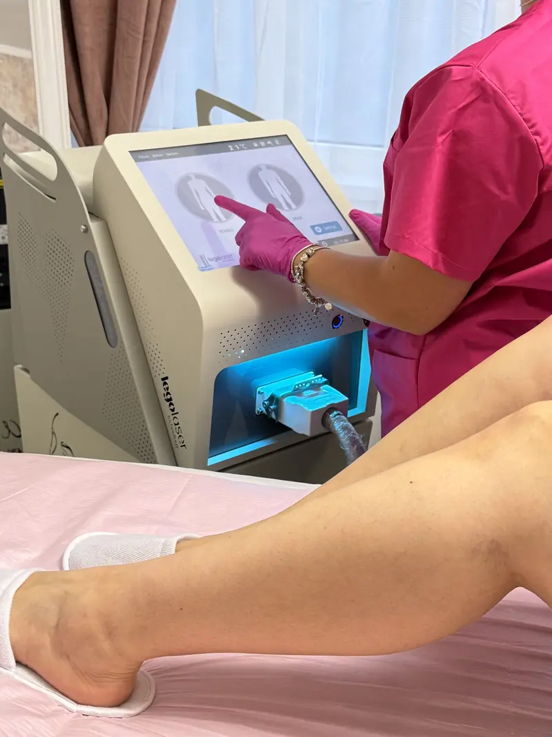Setarea parametrilor pe ecranul laserului Legolaser ERIDE Smart Dual înainte de o ședință de epilare definitivă